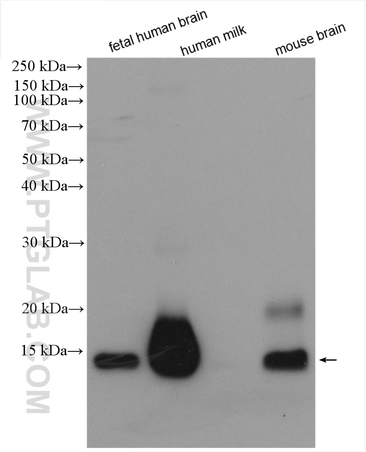 Western Blot (WB) analysis of various lysates using Cystatin C Polyclonal antibody (12245-1-AP)