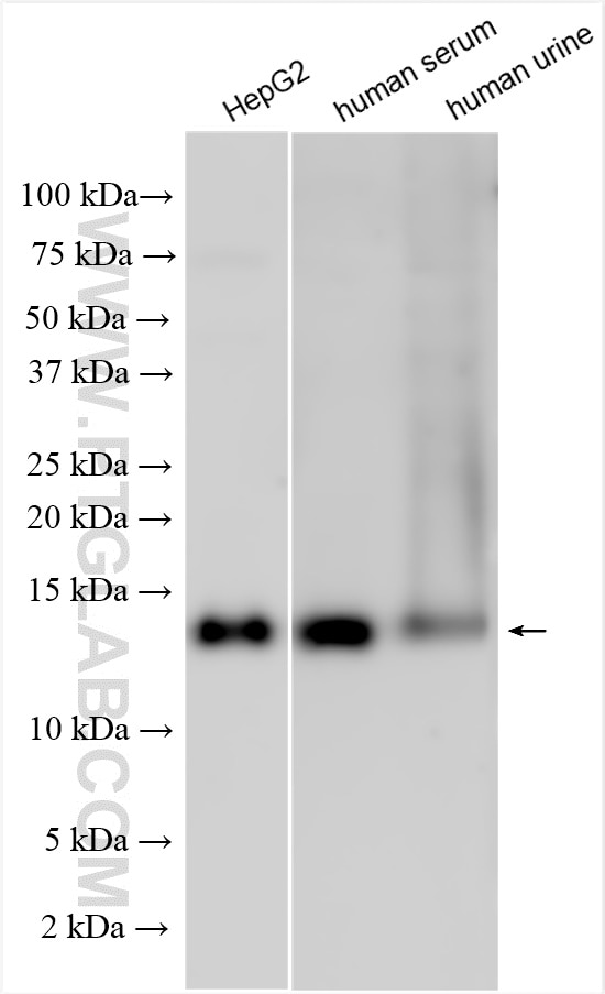 Western Blot (WB) analysis of various lysates using Cystatin C Polyclonal antibody (12245-1-AP)