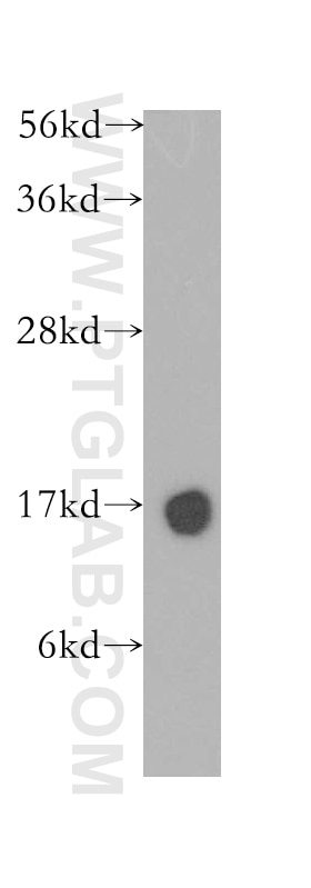 Western Blot (WB) analysis of human brain tissue using Cystatin C Polyclonal antibody (12245-1-AP)