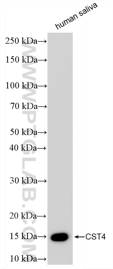 WB analysis of human saliva using 86955-1-RR Western Blot (WB) analysis of human saliva using CST4 Recombinant monoclonal antibody (86955-1-RR)