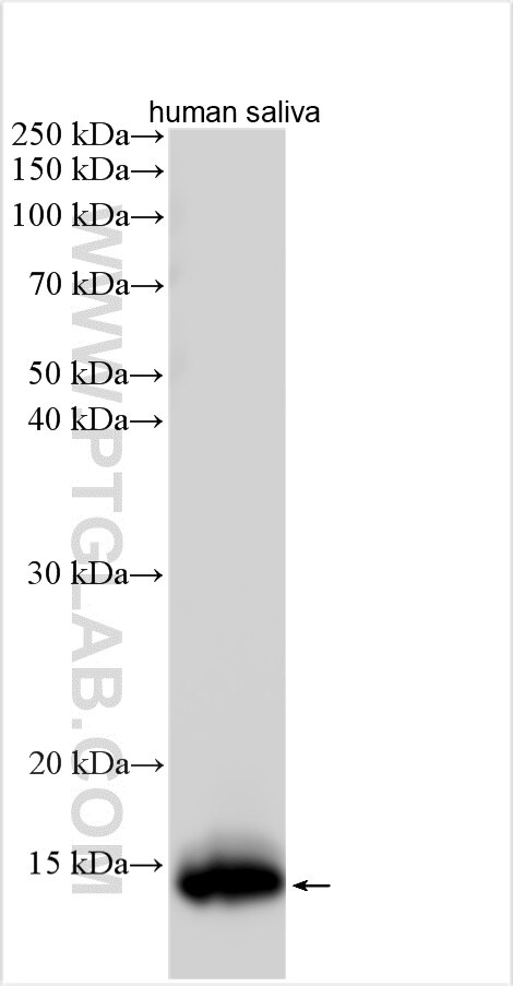 Western Blot (WB) analysis of various lysates using CST5 Polyclonal antibody (30988-1-AP)