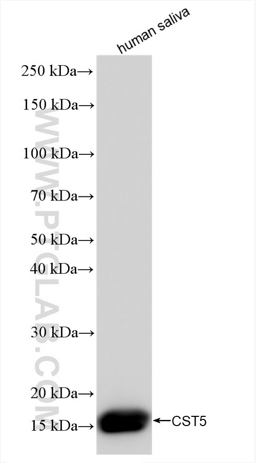 Western Blot (WB) analysis of human saliva using CST5 Recombinant antibody (84678-4-RR)