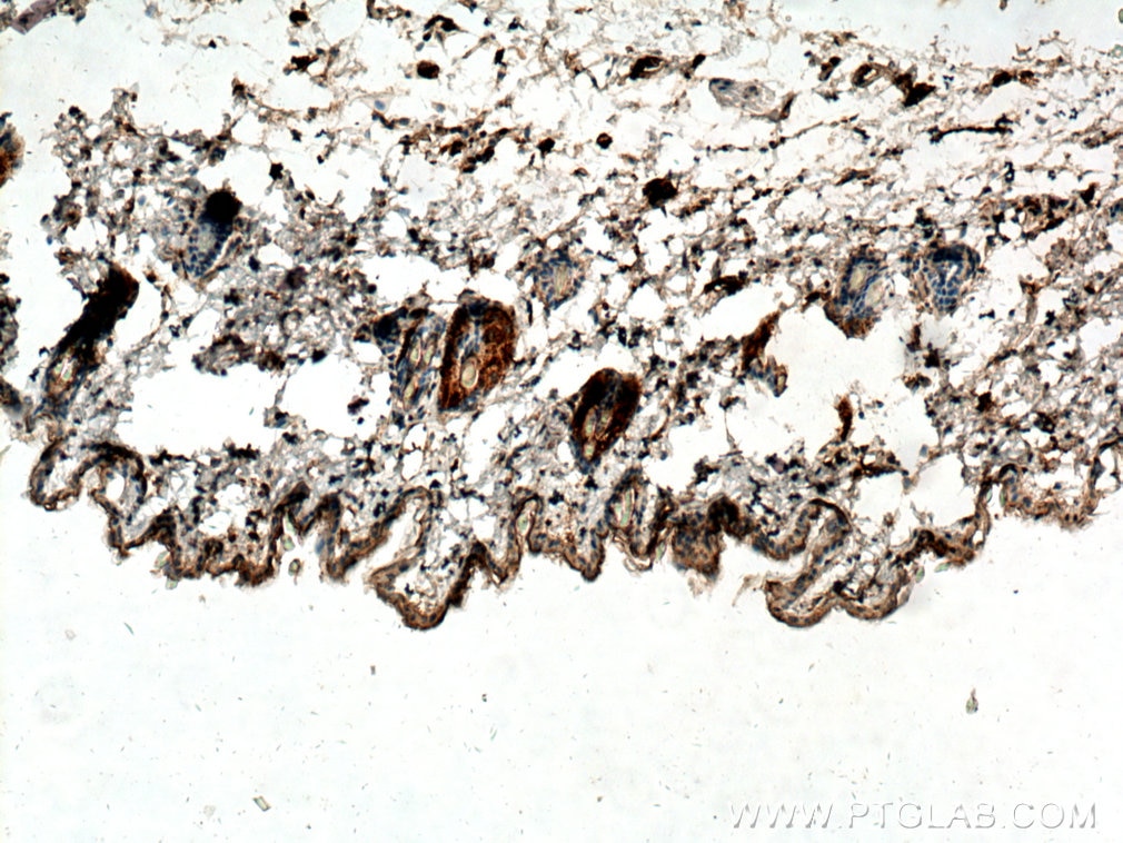 IHC staining of mouse skin using 17076-1-AP