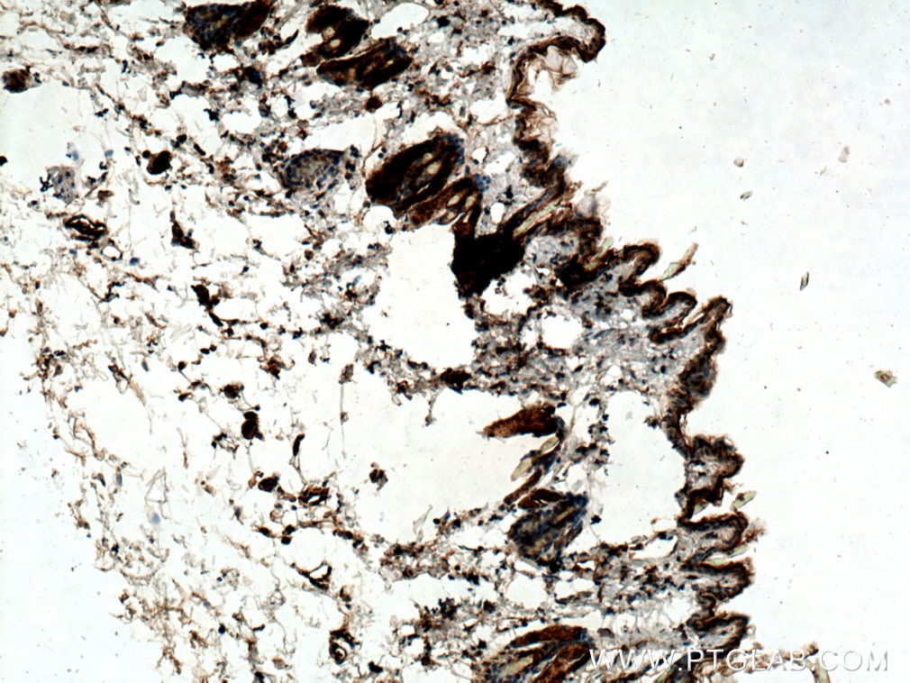 Immunohistochemistry (IHC) staining of mouse skin tissue using CST6 Polyclonal antibody (17076-1-AP)