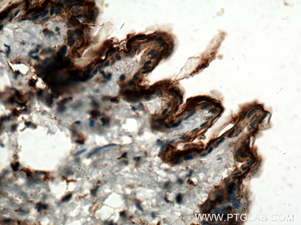 Immunohistochemistry (IHC) staining of mouse skin tissue using CST6 Polyclonal antibody (17076-1-AP)