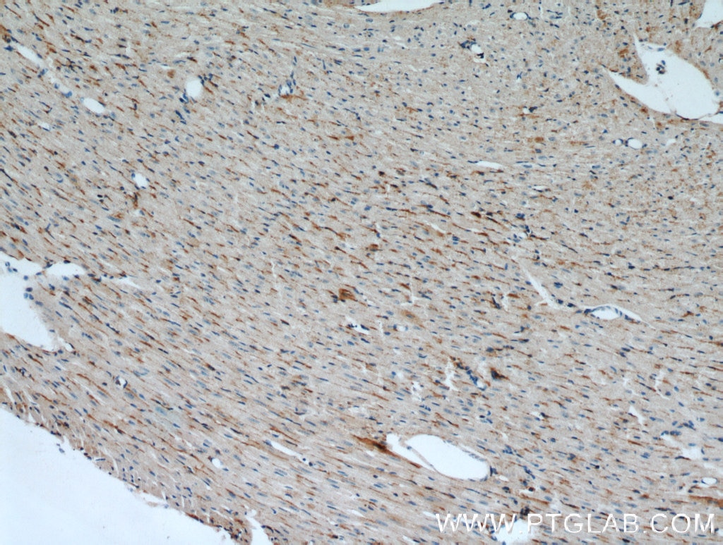 Immunohistochemistry (IHC) staining of mouse heart tissue using CST6 Polyclonal antibody (17076-1-AP)