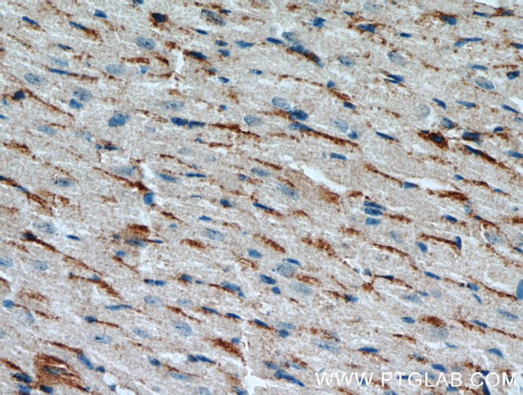 Immunohistochemistry (IHC) staining of mouse heart tissue using CST6 Polyclonal antibody (17076-1-AP)