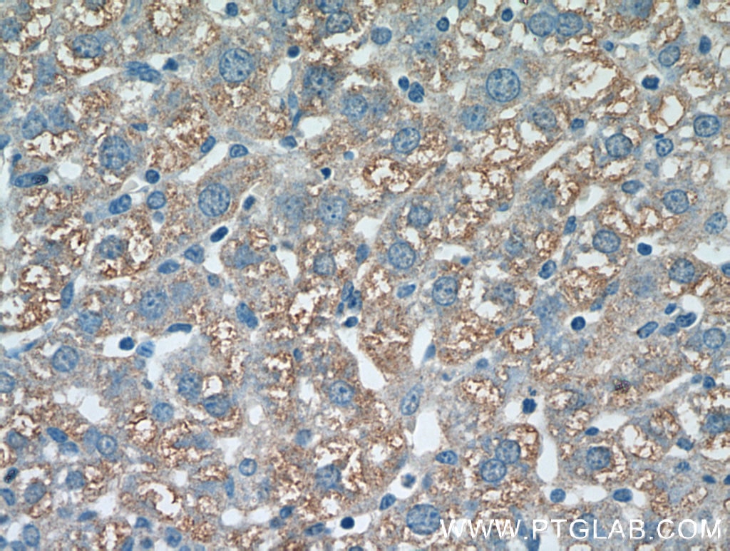 Immunohistochemistry (IHC) staining of mouse liver tissue using CST6 Polyclonal antibody (17076-1-AP)
