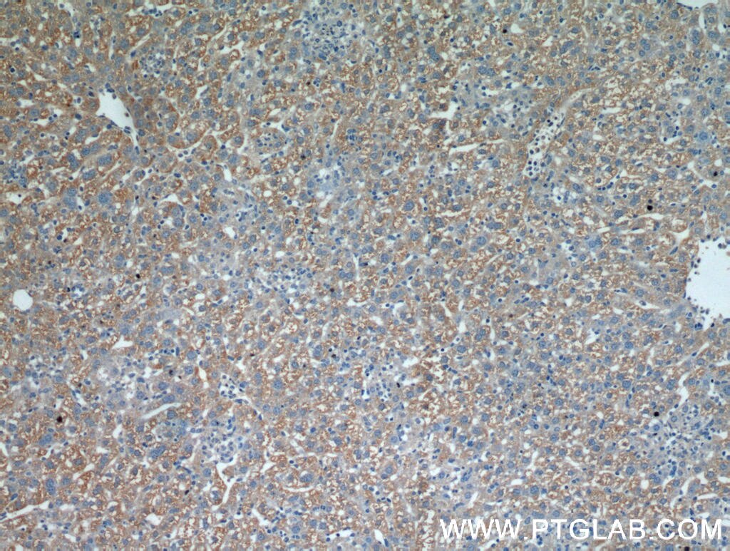 Immunohistochemistry (IHC) staining of mouse liver tissue using CST6 Polyclonal antibody (17076-1-AP)