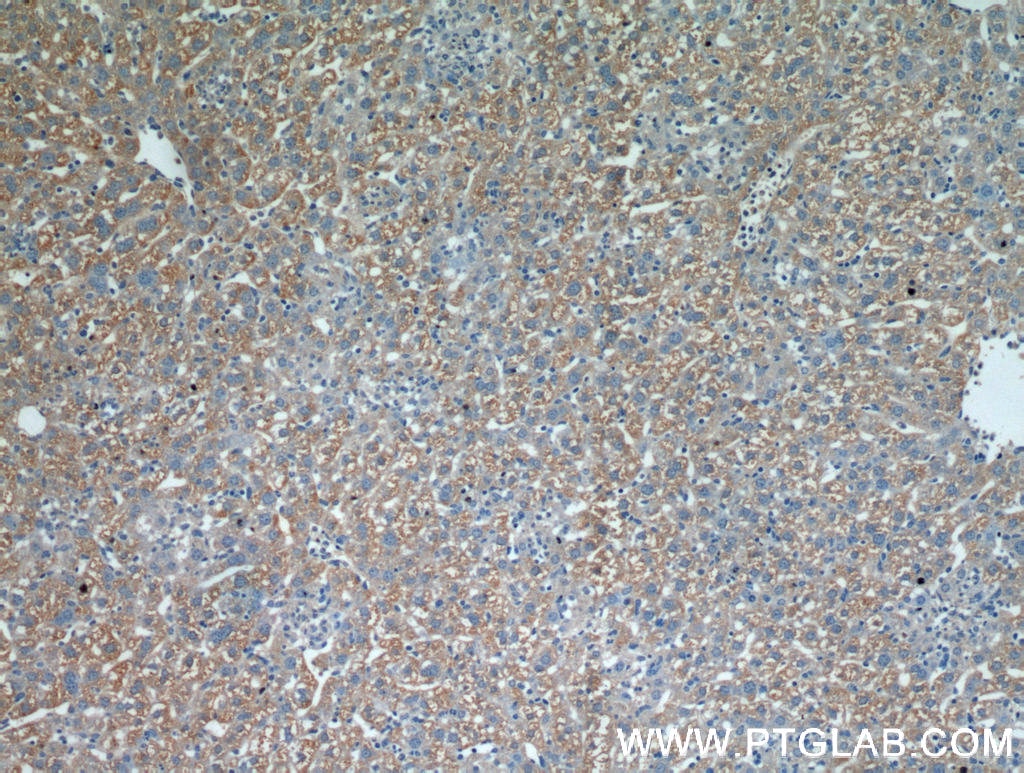 Immunohistochemistry (IHC) staining of mouse liver tissue using CST6 Polyclonal antibody (17076-1-AP)