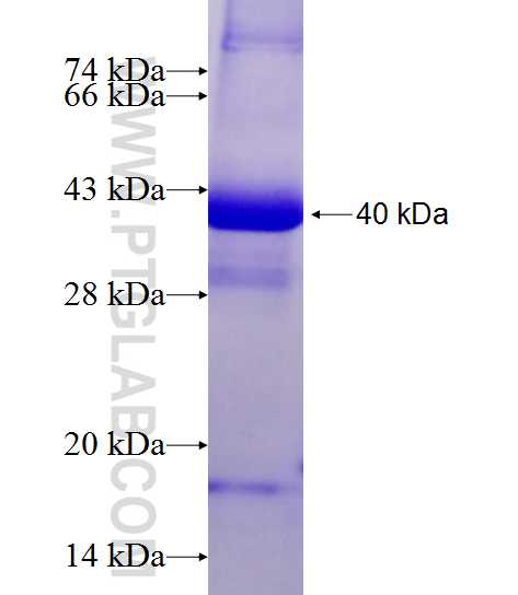 CST6 fusion protein Ag10965 SDS-PAGE