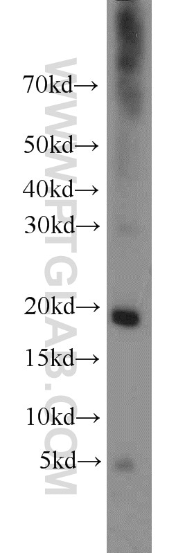 Western Blot (WB) analysis of mouse uterus tissue using Cystatin F Polyclonal antibody (12073-1-AP)