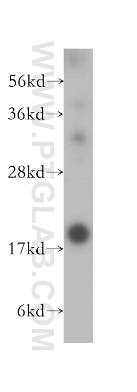 Western Blot (WB) analysis of Jurkat cells using Cystatin F Polyclonal antibody (12073-1-AP)