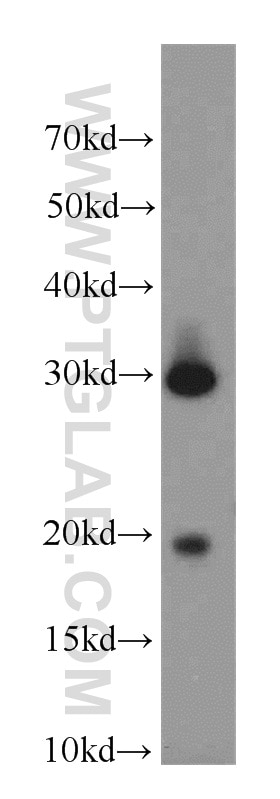 Western Blot (WB) analysis of human testis tissue using CST8 Polyclonal antibody (18183-1-AP)