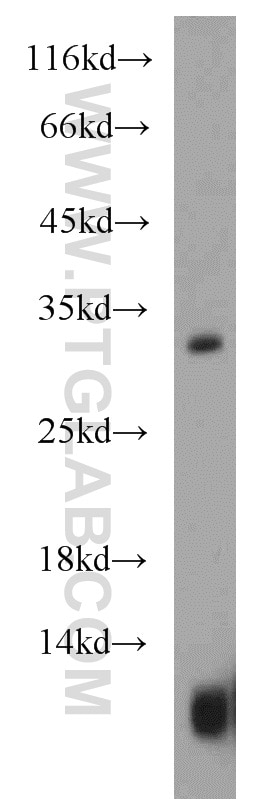 Western Blot (WB) analysis of DU 145 cells using CST8 Polyclonal antibody (18183-1-AP)