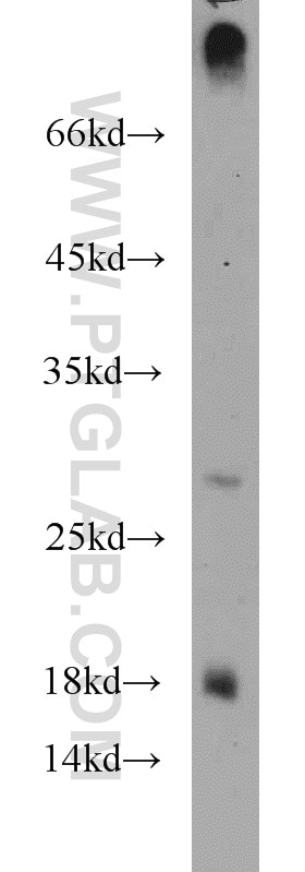 Western Blot (WB) analysis of HEK-293 cells using CST8 Polyclonal antibody (18183-1-AP)