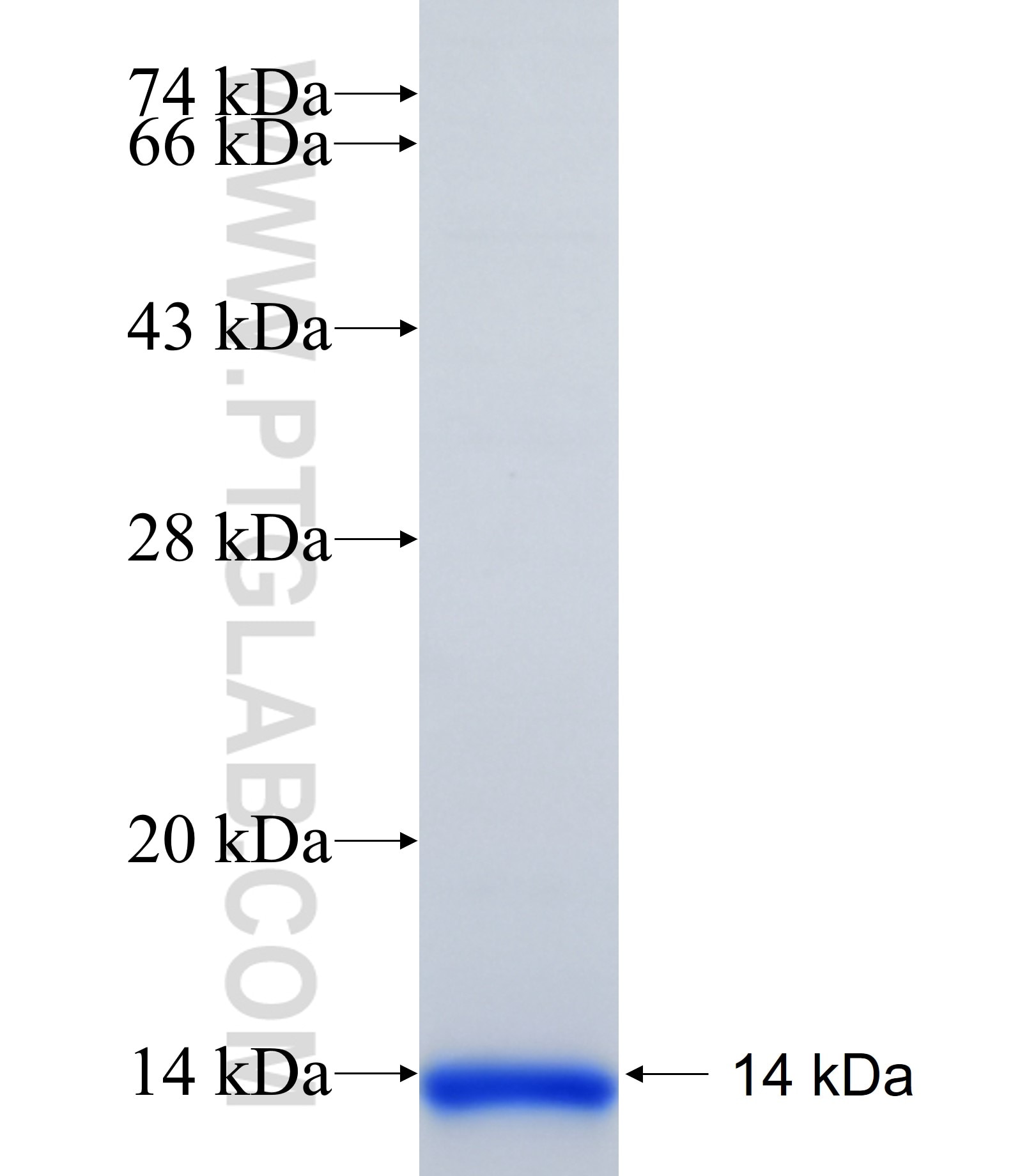 CST9 fusion protein Ag19689 SDS-PAGE