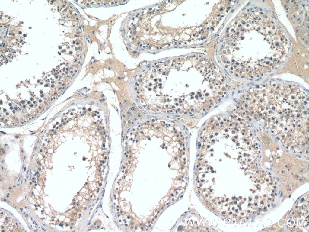 Immunohistochemistry (IHC) staining of human testis tissue using CST9L Polyclonal antibody (13649-1-AP)