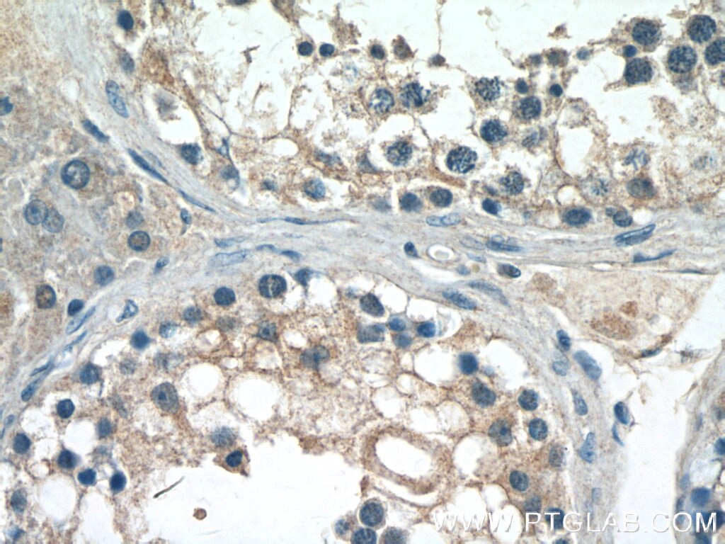 Immunohistochemistry (IHC) staining of human testis tissue using CST9L Polyclonal antibody (13649-1-AP)