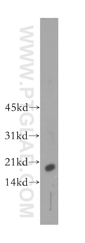 Western Blot (WB) analysis of human kidney tissue using CST9L Polyclonal antibody (13649-1-AP)