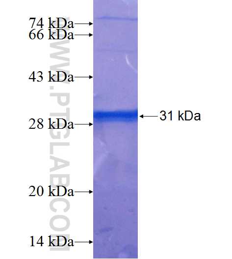 CST9L fusion protein Ag25440 SDS-PAGE
