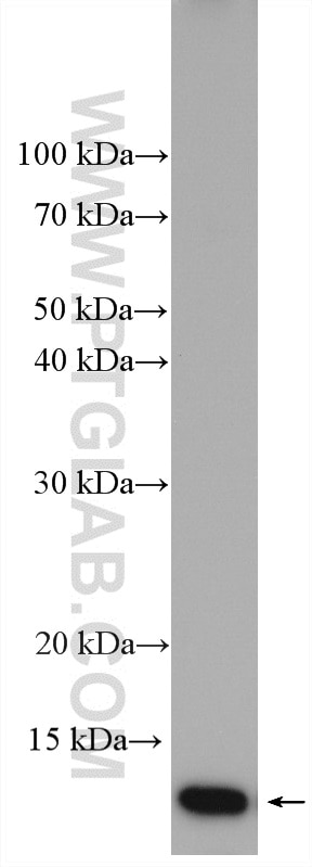 Western Blot (WB) analysis of human saliva using Cystatin A Polyclonal antibody (15962-1-AP)