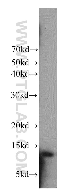 Western Blot (WB) analysis of NIH/3T3 cells using Cystatin A Polyclonal antibody (15962-1-AP)