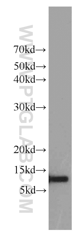 Western Blot (WB) analysis of A549 cells using Cystatin A Polyclonal antibody (15962-1-AP)