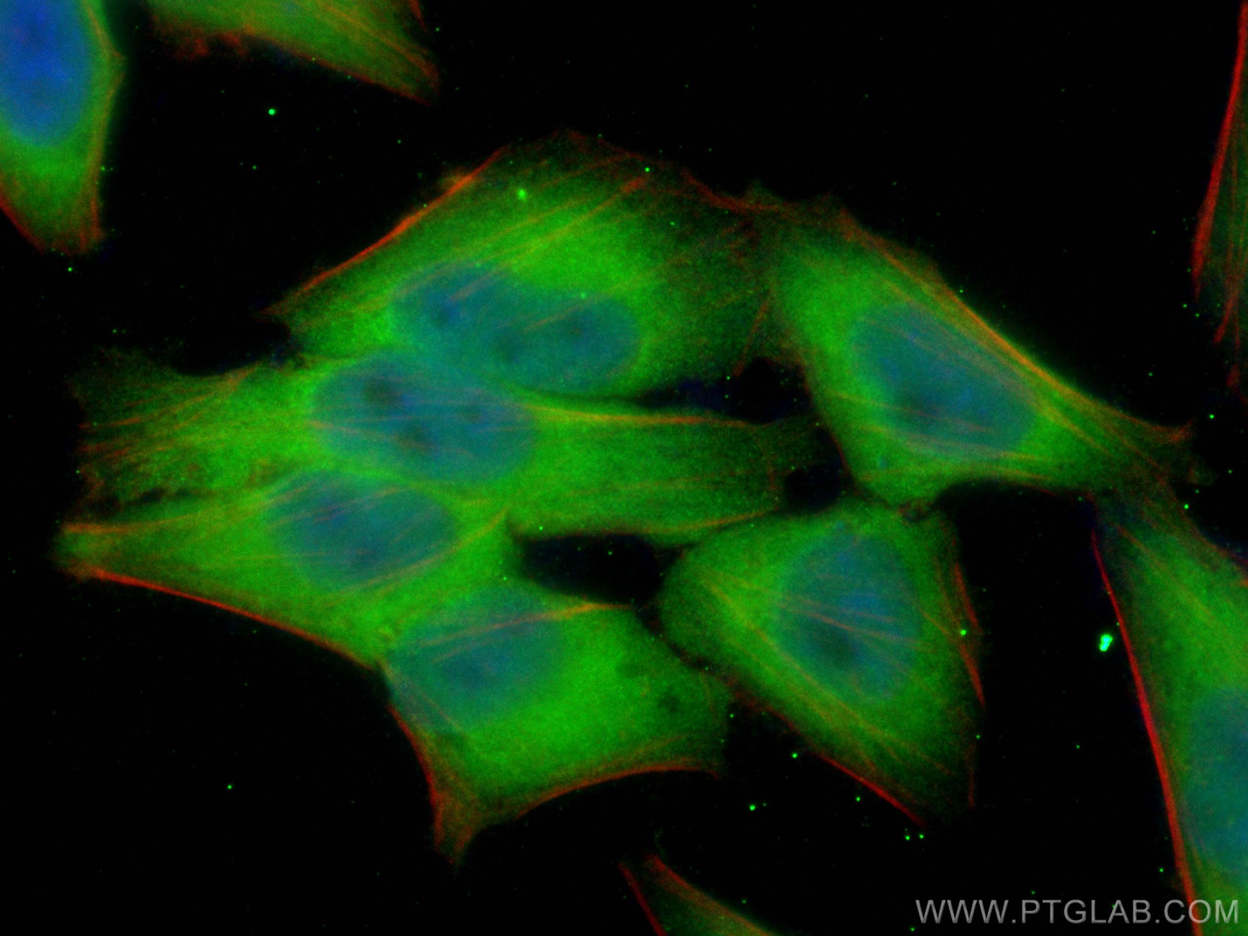 Immunofluorescence (IF) / fluorescent staining of HepG2 cells using Cystatin B Polyclonal antibody (10823-1-AP)