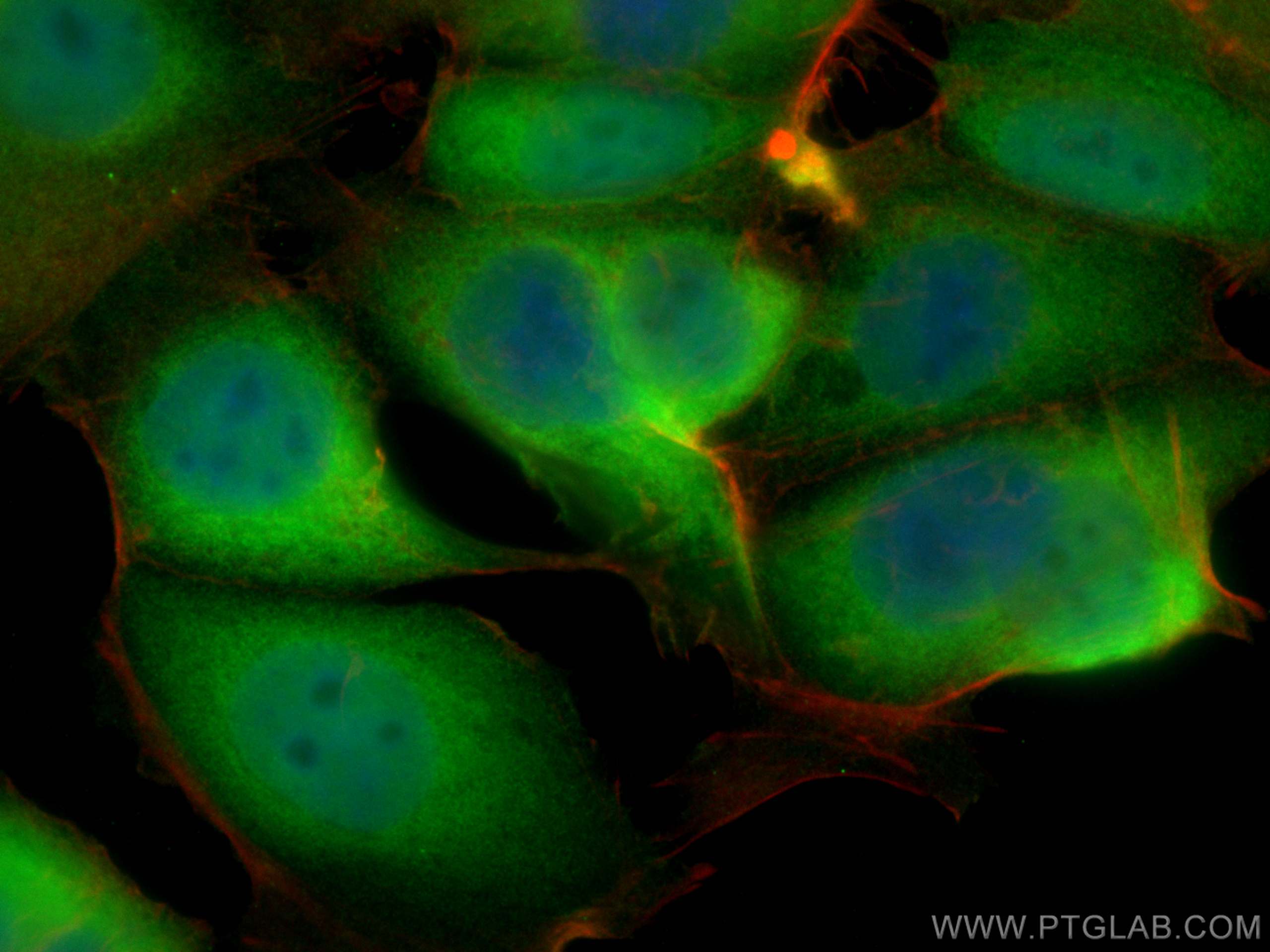 Immunofluorescence (IF) / fluorescent staining of MCF-7 cells using Cystatin B Polyclonal antibody (10823-1-AP)