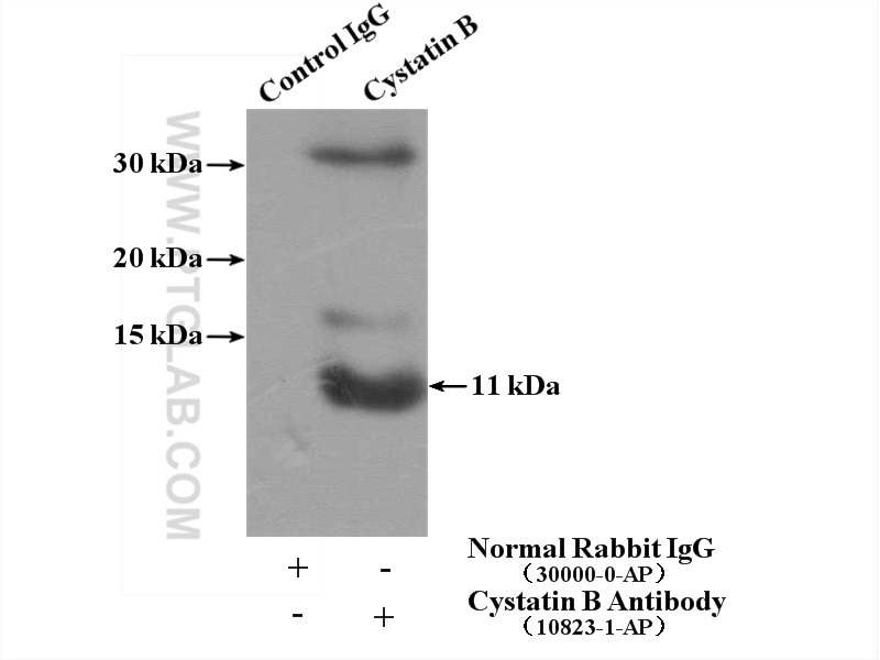 Immunoprecipitation (IP) experiment of MCF-7 cells using Cystatin B Polyclonal antibody (10823-1-AP)