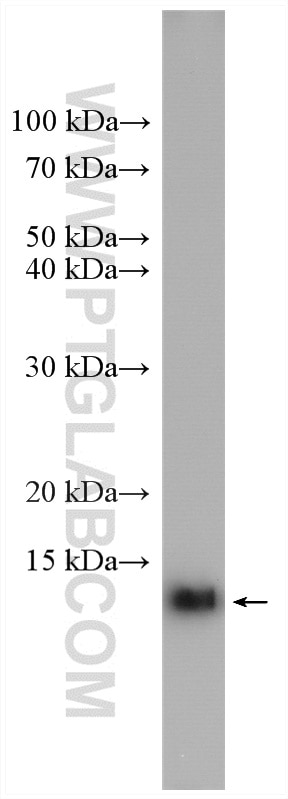 WB analysis of human saliva using 10823-1-AP