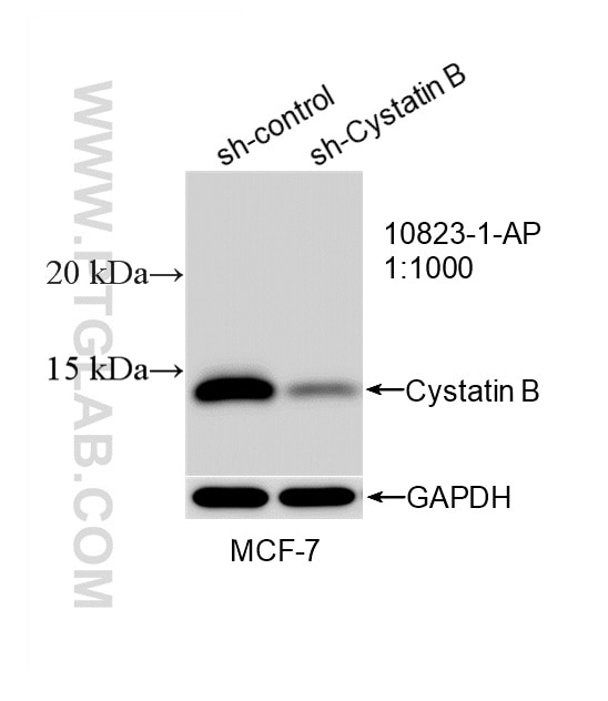 WB analysis of MCF-7 using 10823-1-AP Western Blot (WB) analysis of MCF-7 cells using Cystatin B Polyclonal antibody (10823-1-AP)