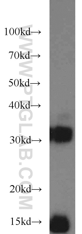 Western Blot (WB) analysis of MCF-7 cells using Cystatin B Polyclonal antibody (10823-1-AP)