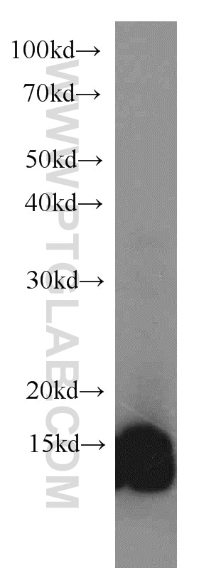 Western Blot (WB) analysis of HepG2 cells using Cystatin B Polyclonal antibody (10823-1-AP)