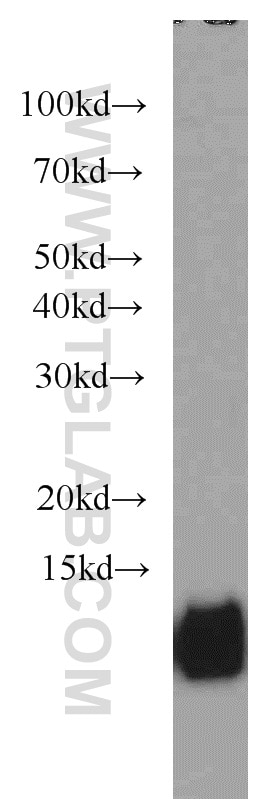 Western Blot (WB) analysis of MCF-7 cells using Cystatin B Polyclonal antibody (10823-1-AP)