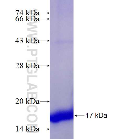 CSTB fusion protein Ag21291 SDS-PAGE
