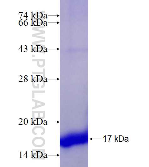 CSTB fusion protein Ag21291 SDS-PAGE