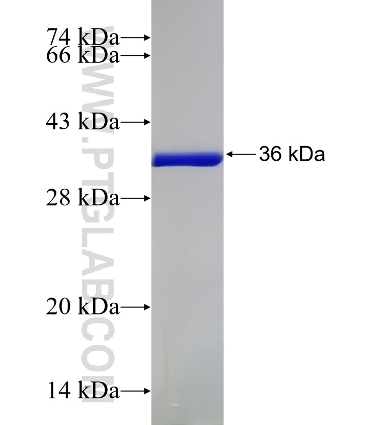 CSTB fusion protein Ag1262 SDS-PAGE