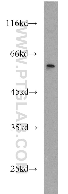 CSTF1 Polyclonal antibody