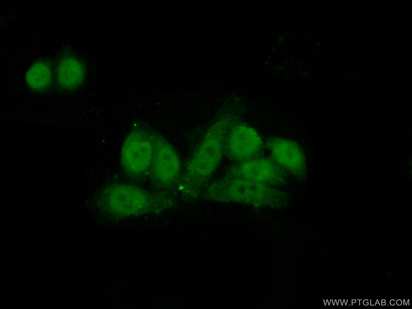 Immunofluorescence (IF) / fluorescent staining of HeLa cells using CSTF1 Polyclonal antibody (15537-1-AP)