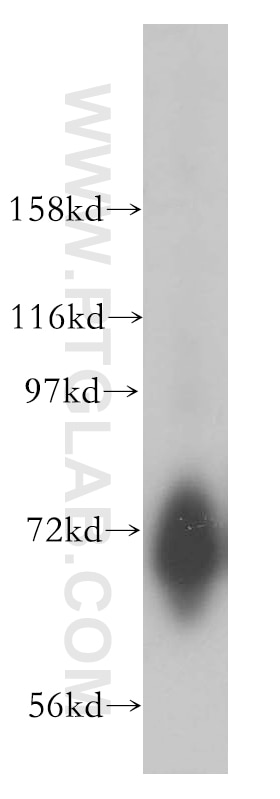 Western Blot (WB) analysis of human brain tissue using CSTF2T Polyclonal antibody (14206-1-AP)