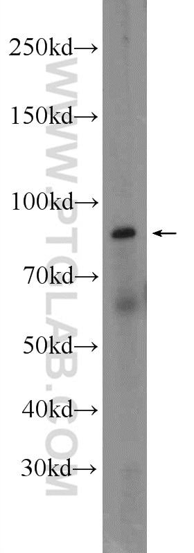 Western Blot (WB) analysis of A431 cells using CSTF3 Polyclonal antibody (24290-1-AP)