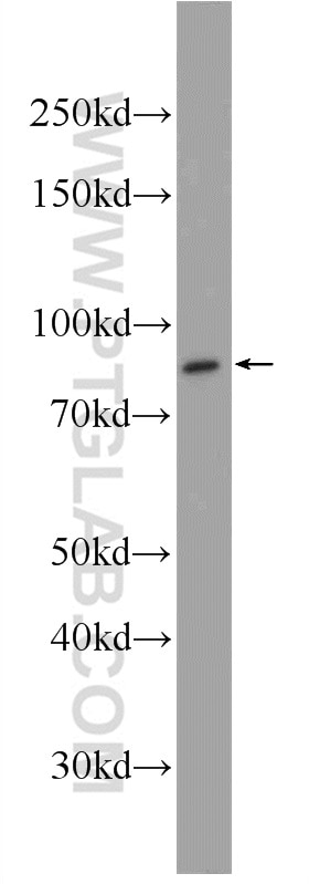 Western Blot (WB) analysis of A431 cells using CSTF3 Polyclonal antibody (24290-1-AP)