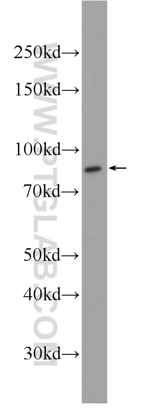 WB analysis of A431 using 24290-1-AP