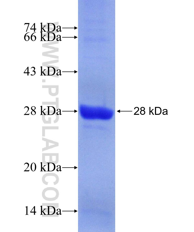 CT45A3 fusion protein Ag10618 SDS-PAGE