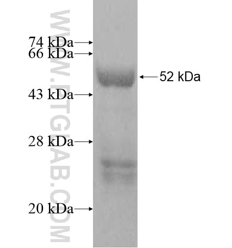 CT45A3 fusion protein Ag10888 SDS-PAGE