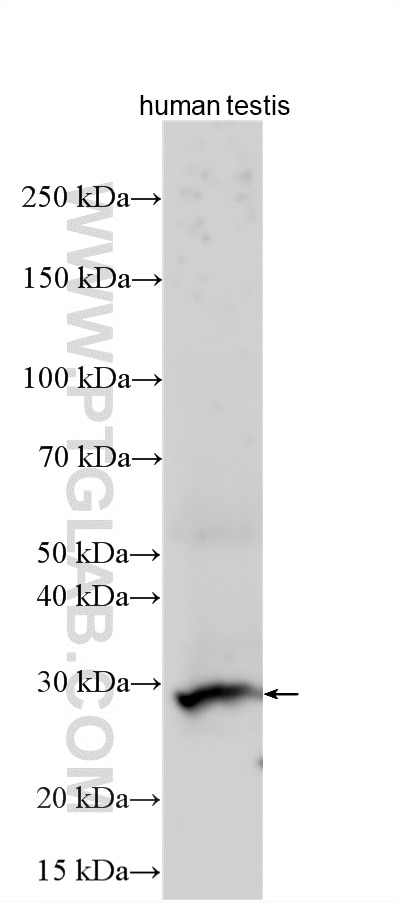 Various lysates were subjected to SDS PAGE followed by western blot with 32040-1-AP (CXorf48 antibody) at dilution of 1:1000 incubated at room temperature for 1.5 hours. Western Blot (WB) analysis of various lysates using CT55 Polyclonal antibody (32040-1-AP)