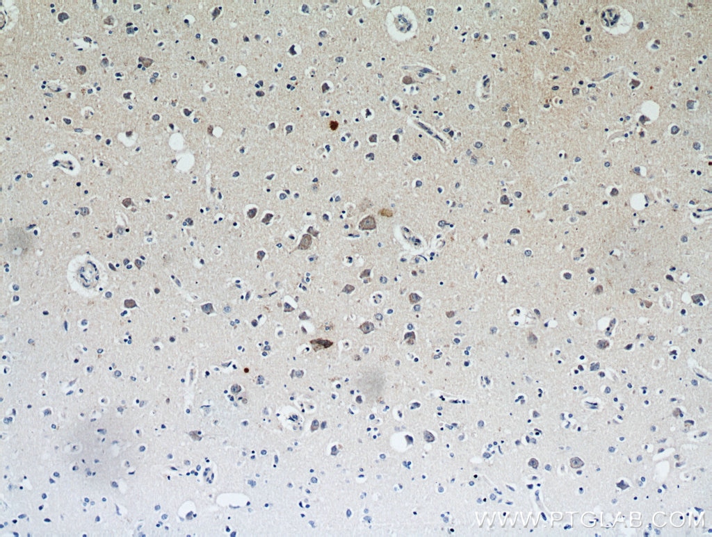 Immunohistochemistry (IHC) staining of human brain tissue using FLJ23584 Polyclonal antibody (21143-1-AP)