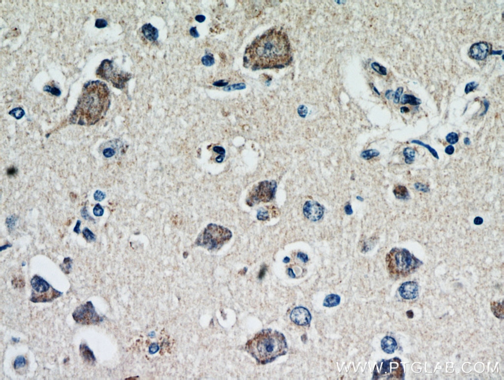 Immunohistochemistry (IHC) staining of human brain tissue using FLJ23584 Polyclonal antibody (21143-1-AP)